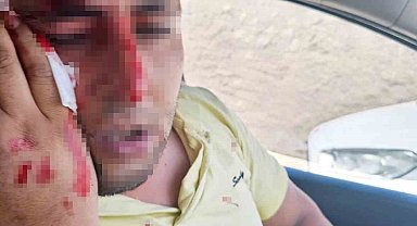 Elektrik dağıtım şirketi personeline saldıran 2 kişi tutuklandı