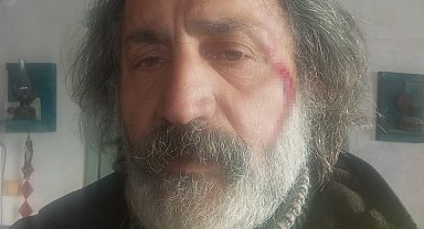 Kurt saldırısından köpekleri sayesinde kurtuldu