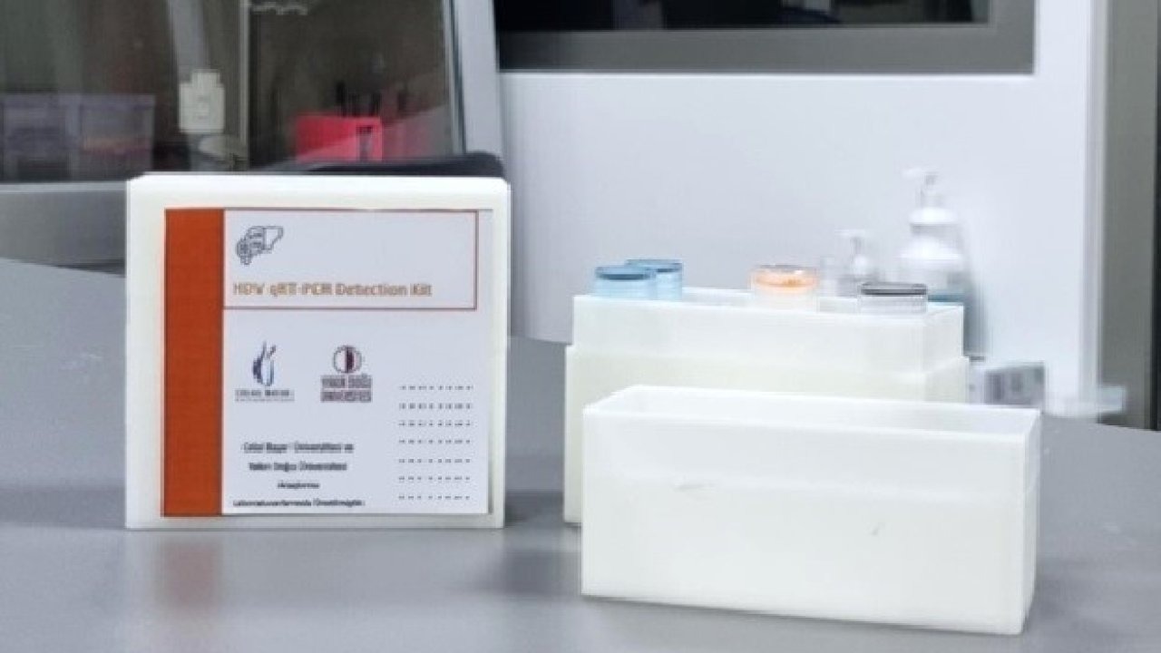 Hepatit D’ye karşı yerli tanı kiti geliştirildi