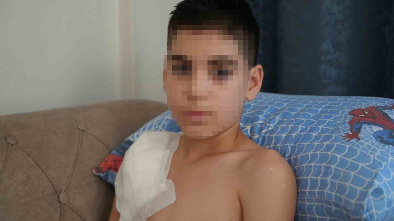 Vücudu köpek tarafından parçalanan Yunus’un kolu kullanılamaz hale geldi, aile adalet arıyor