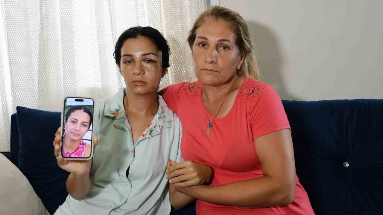 Eski eşinden şiddet gören kadın: "Ben yaşarken kurtulayım, öldükten sonra değil"