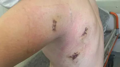 Kız kardeşini korumak isterken 5 yerinden bıçaklanmıştı: O anları anlattı: "Ölümden döndüm"