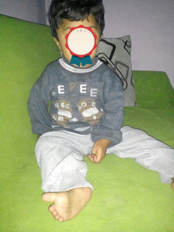 Doğuştan Kemik Hastası 5 yaşındaki HS'ye yardım eli uzandı